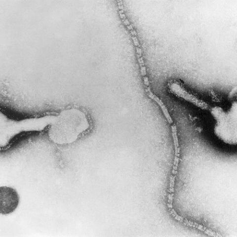 Parainfluenza